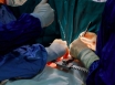 Aussie heart surgery breakthrough